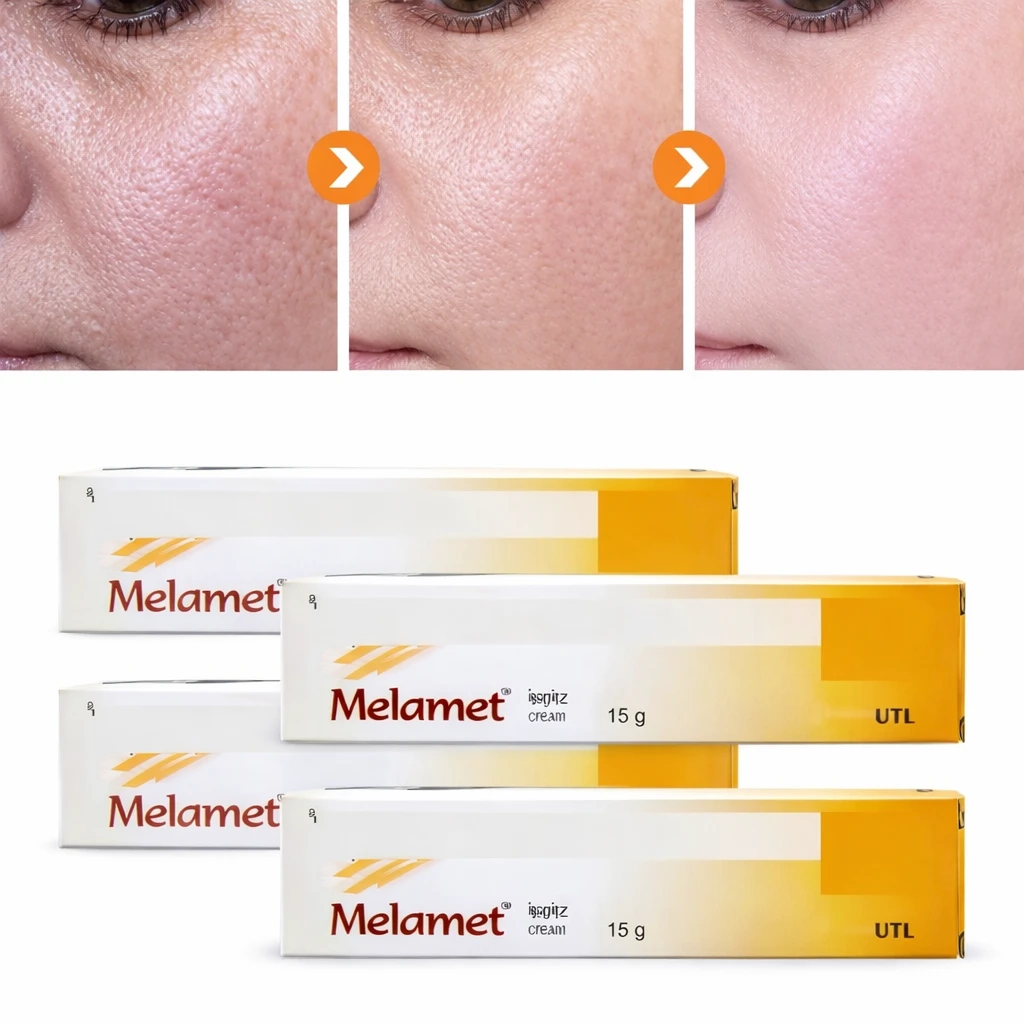 Melamettt Whitening face Gloww cream For Men & Women And all Skinn Type Cream pack of 4